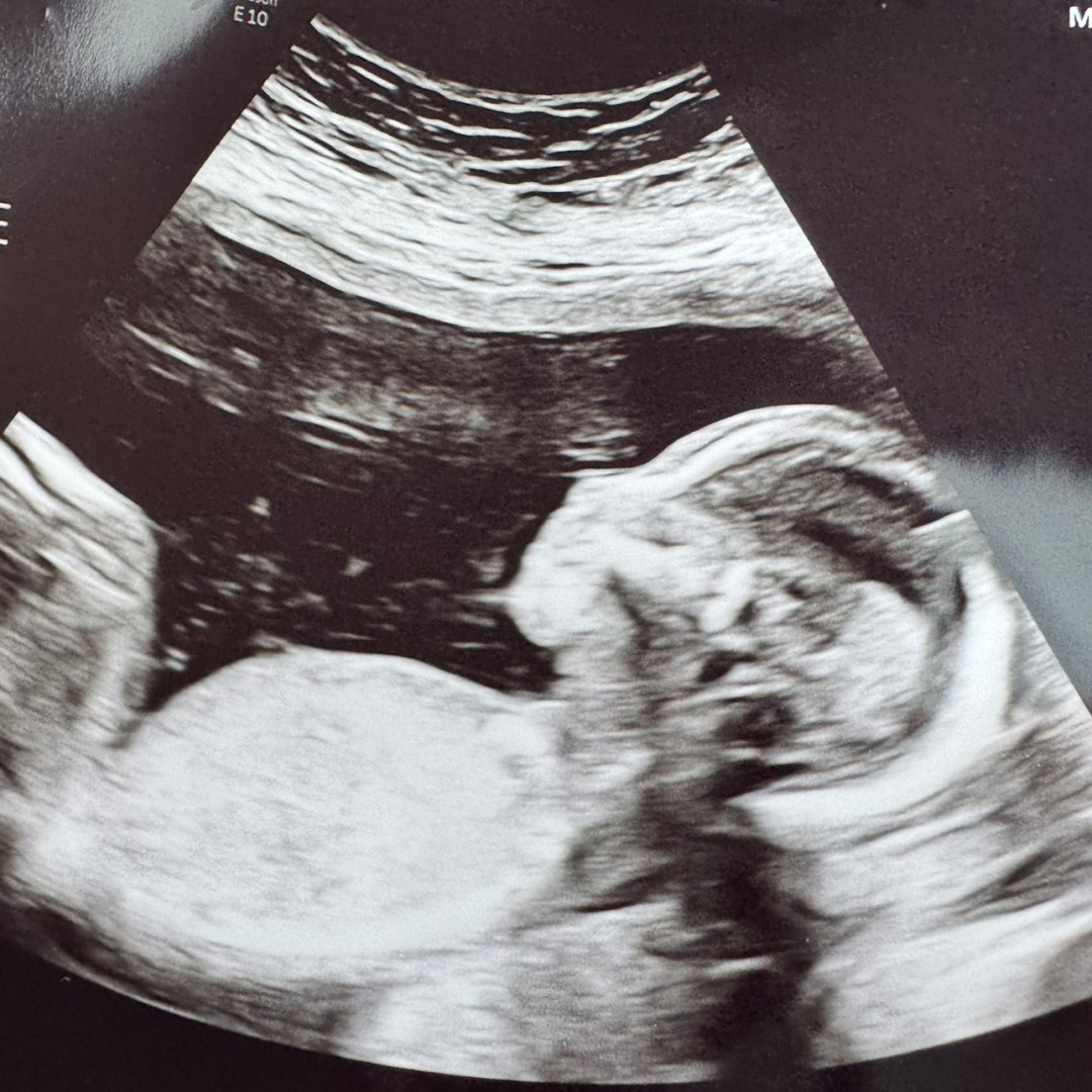 Photo shared by Zoey for their Babylist baby registry.
