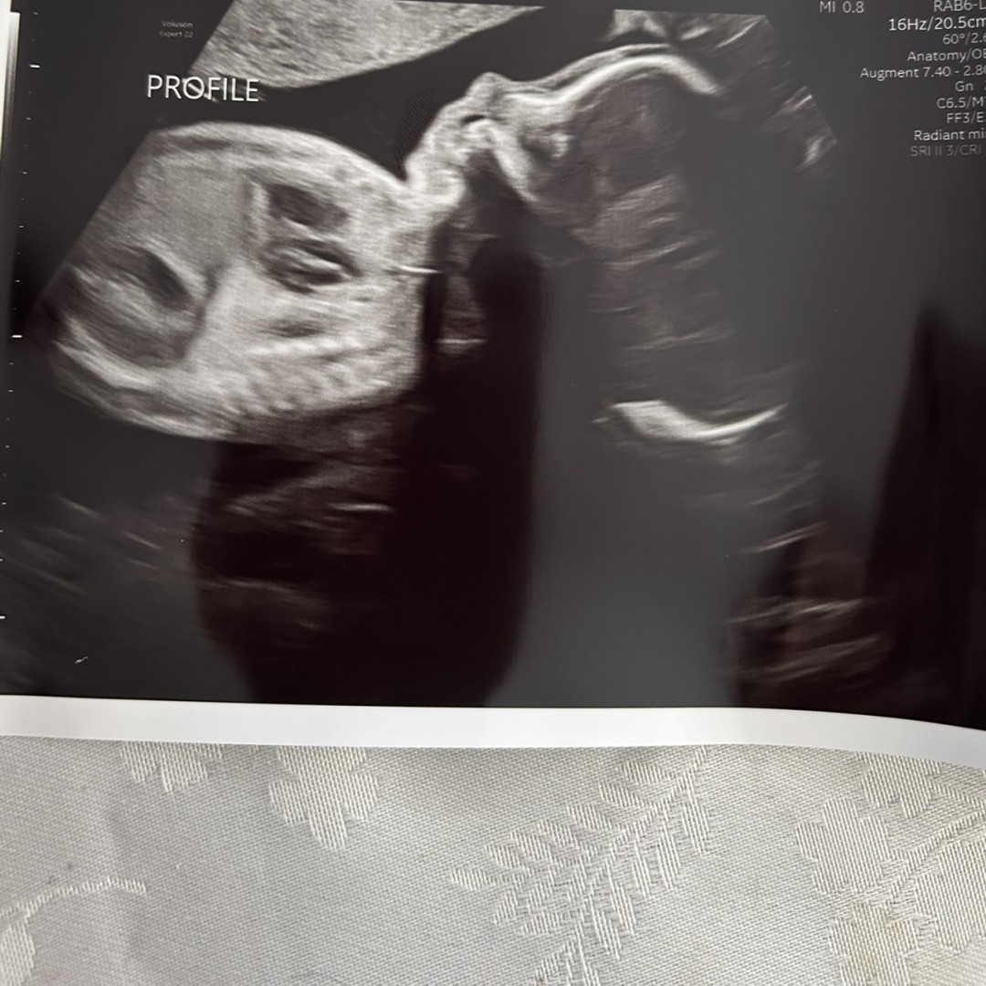 Photo shared by Caitlin for their Babylist baby registry.