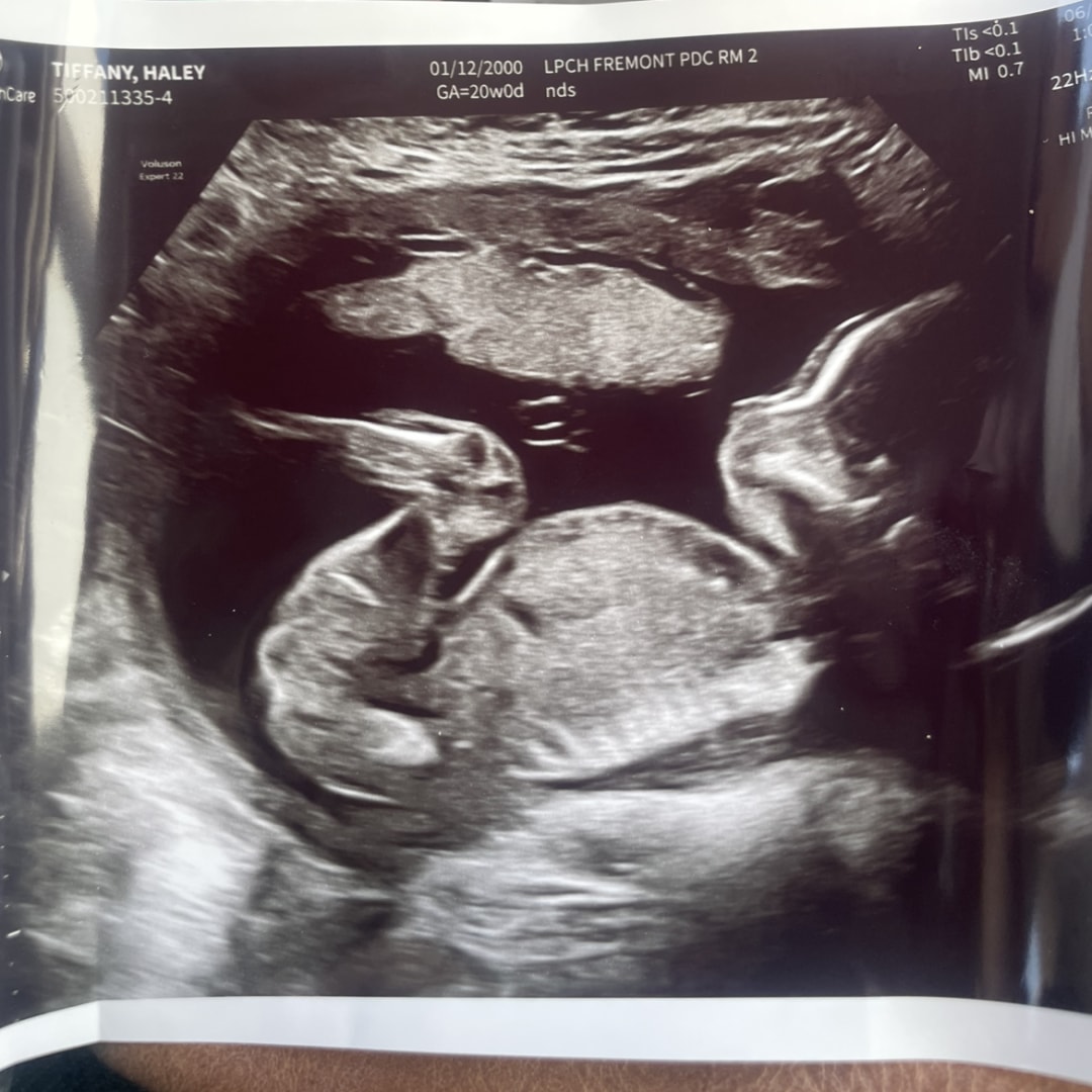 Photo shared by Haley for their Babylist baby registry.