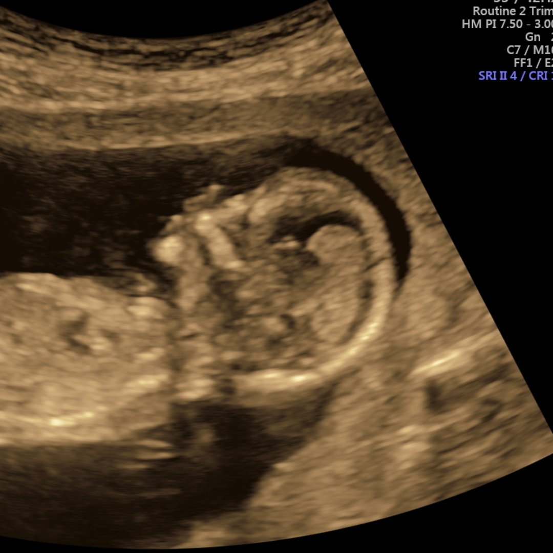 Photo shared by Gracie for their Babylist baby registry.