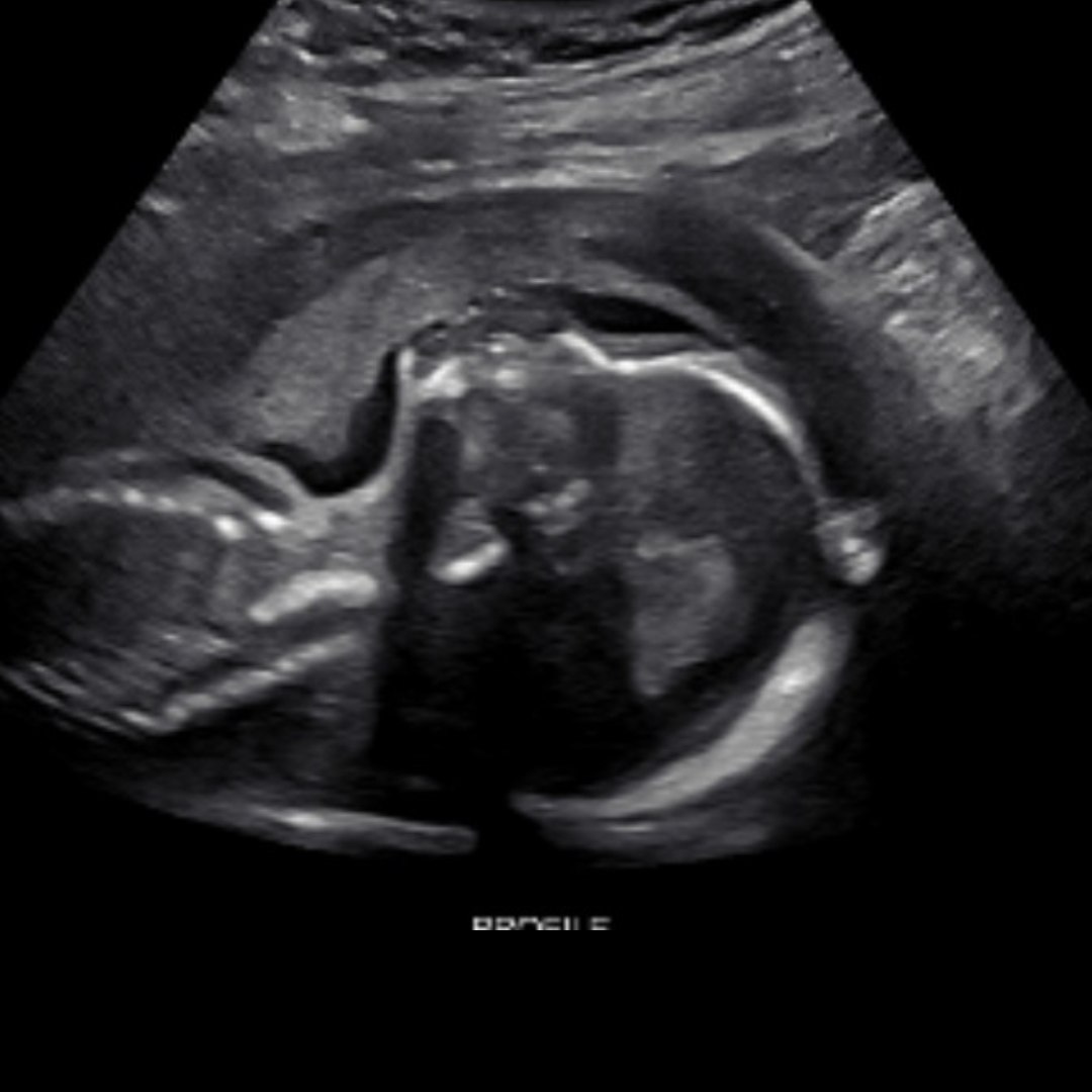 Photo shared by Haley for their Babylist baby registry.