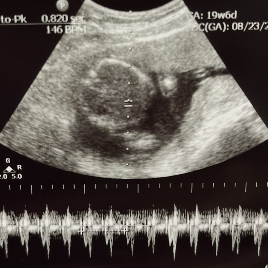 Photo shared by Kyndal for their Babylist baby registry.