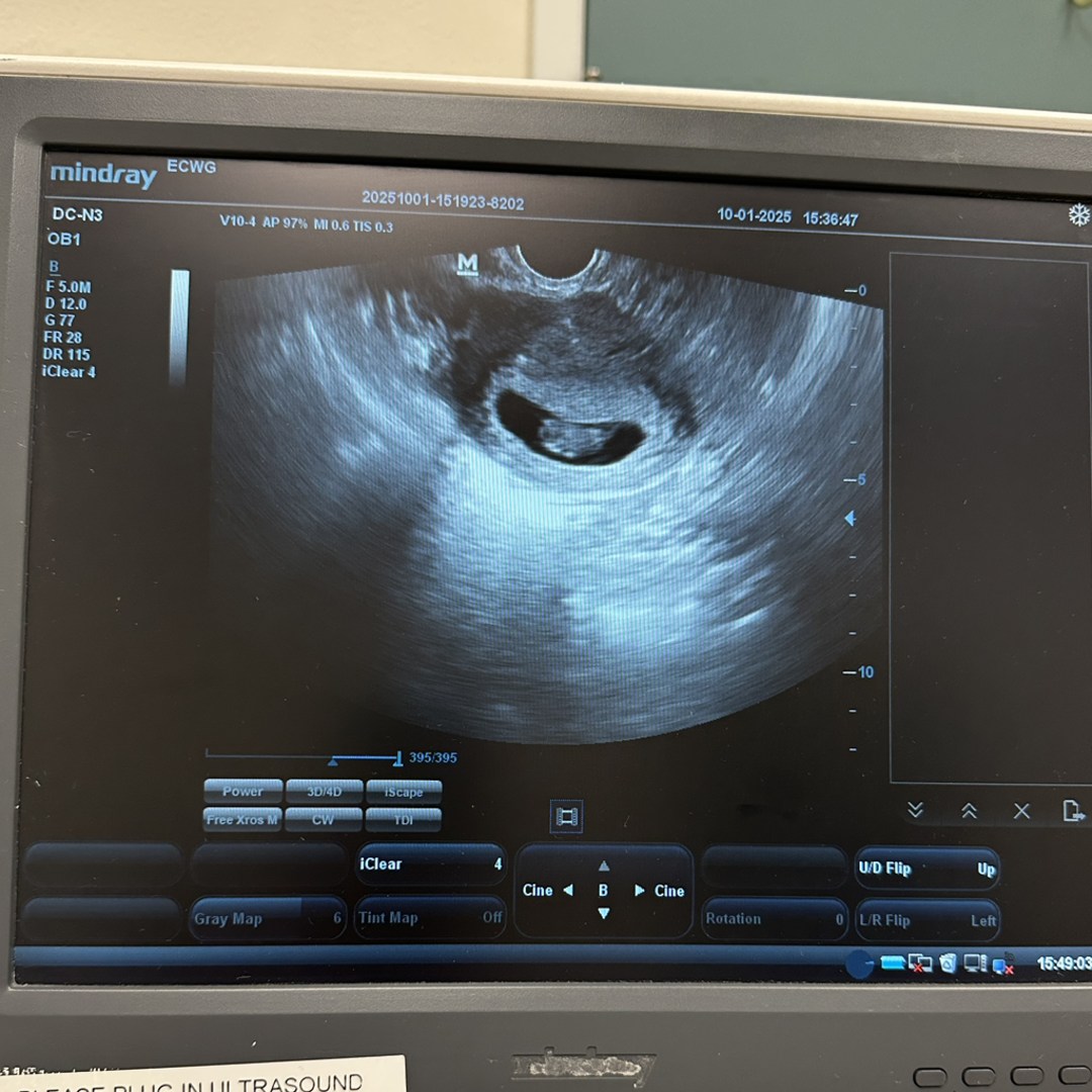 Photo shared by Abigail for their Babylist baby registry.