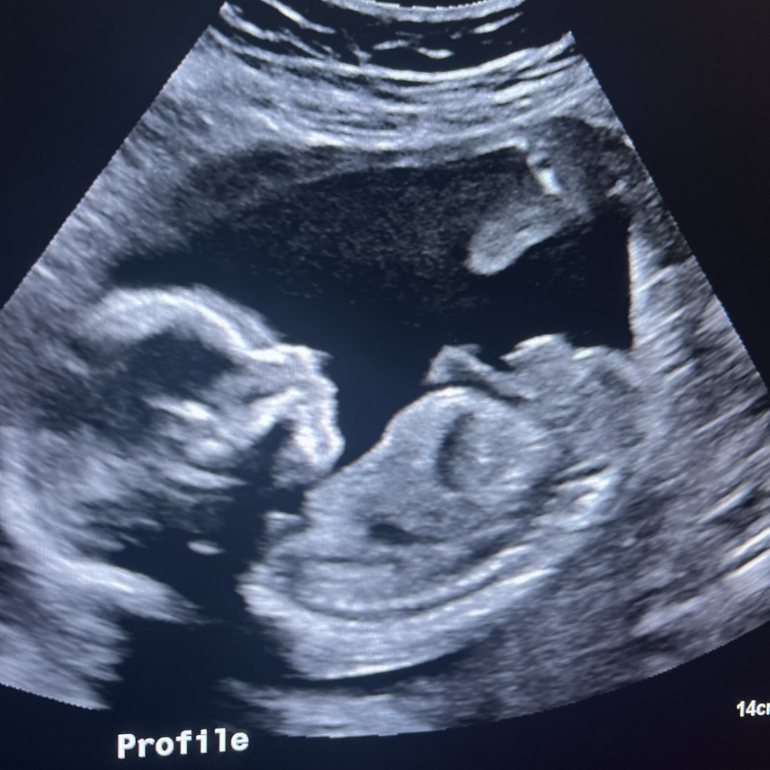Photo shared by Alexandra for their Babylist baby registry.