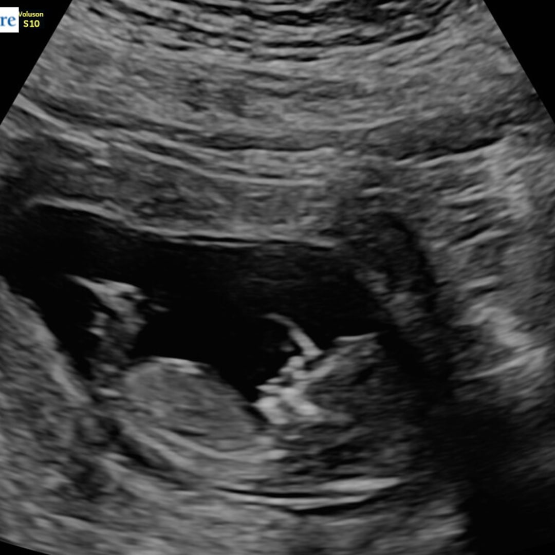 Photo shared by Kayla for their Babylist baby registry.