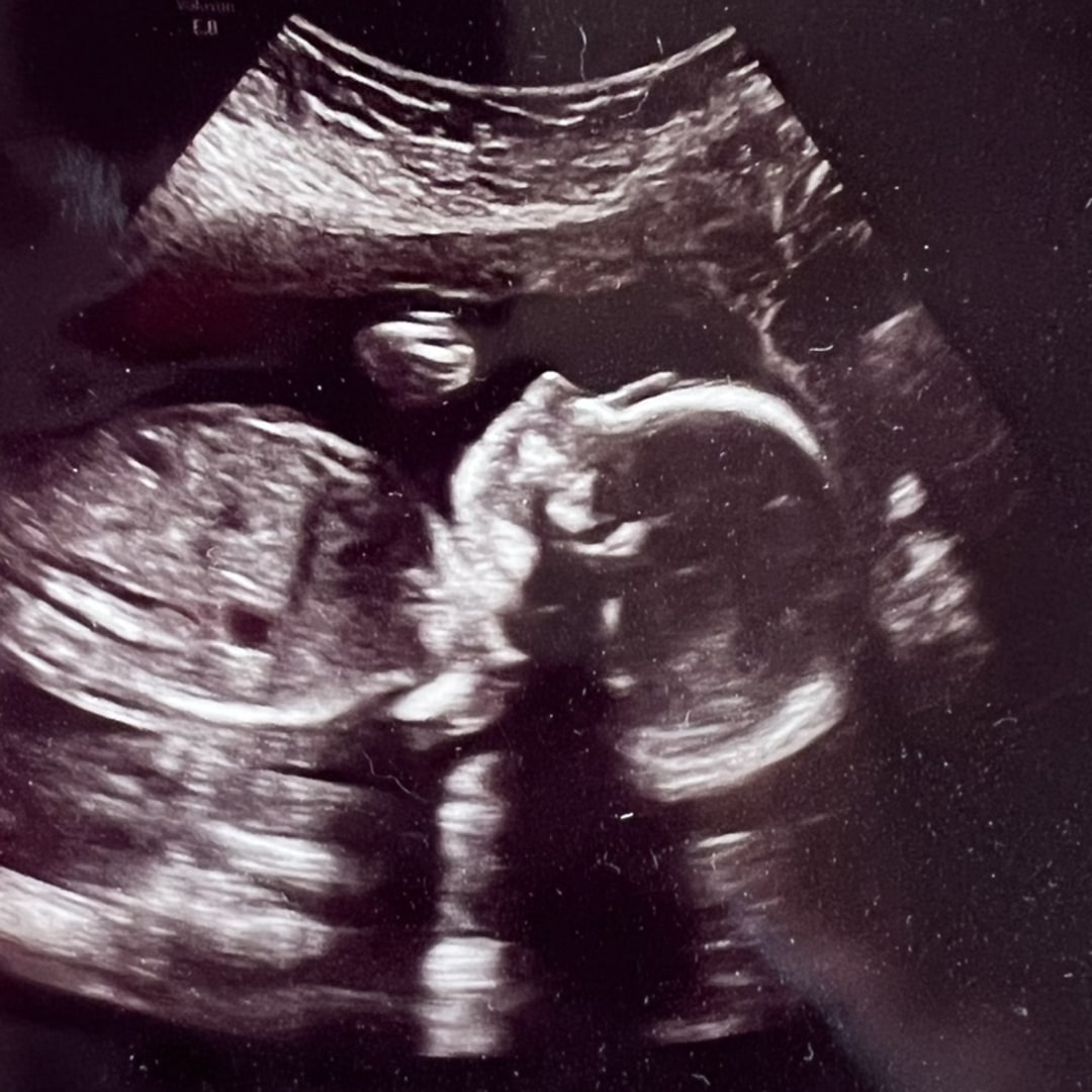 Photo shared by Brooke for their Babylist baby registry.
