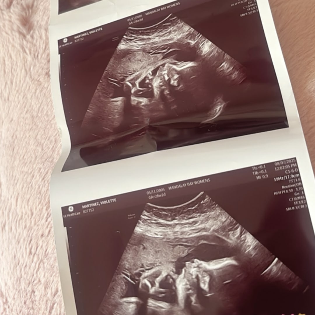 Photo shared by Violette for their Babylist baby registry.