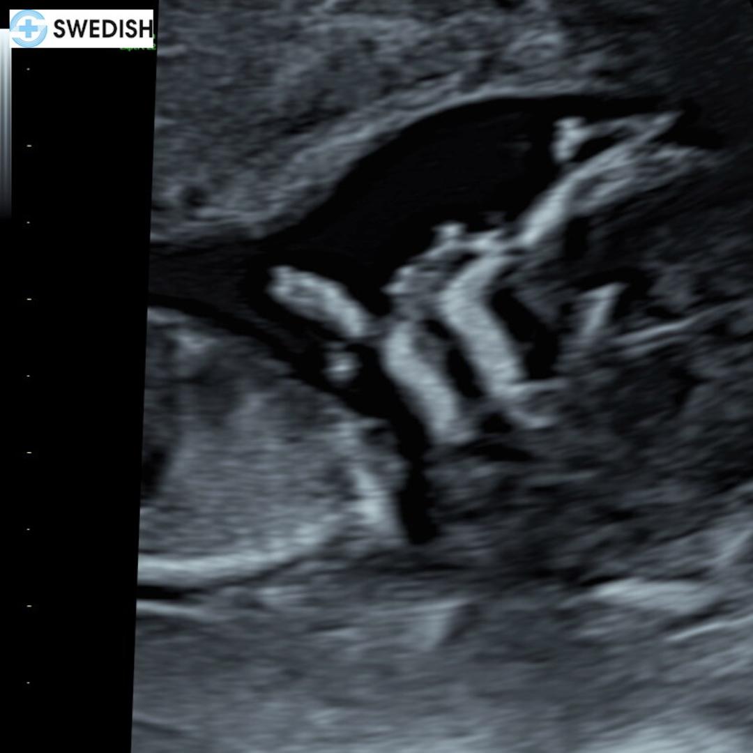 Photo shared by Shayla for their Babylist baby registry.