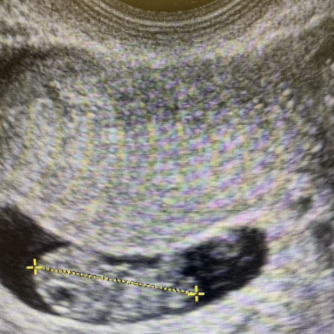 Photo shared by Sydney for their Babylist baby registry.