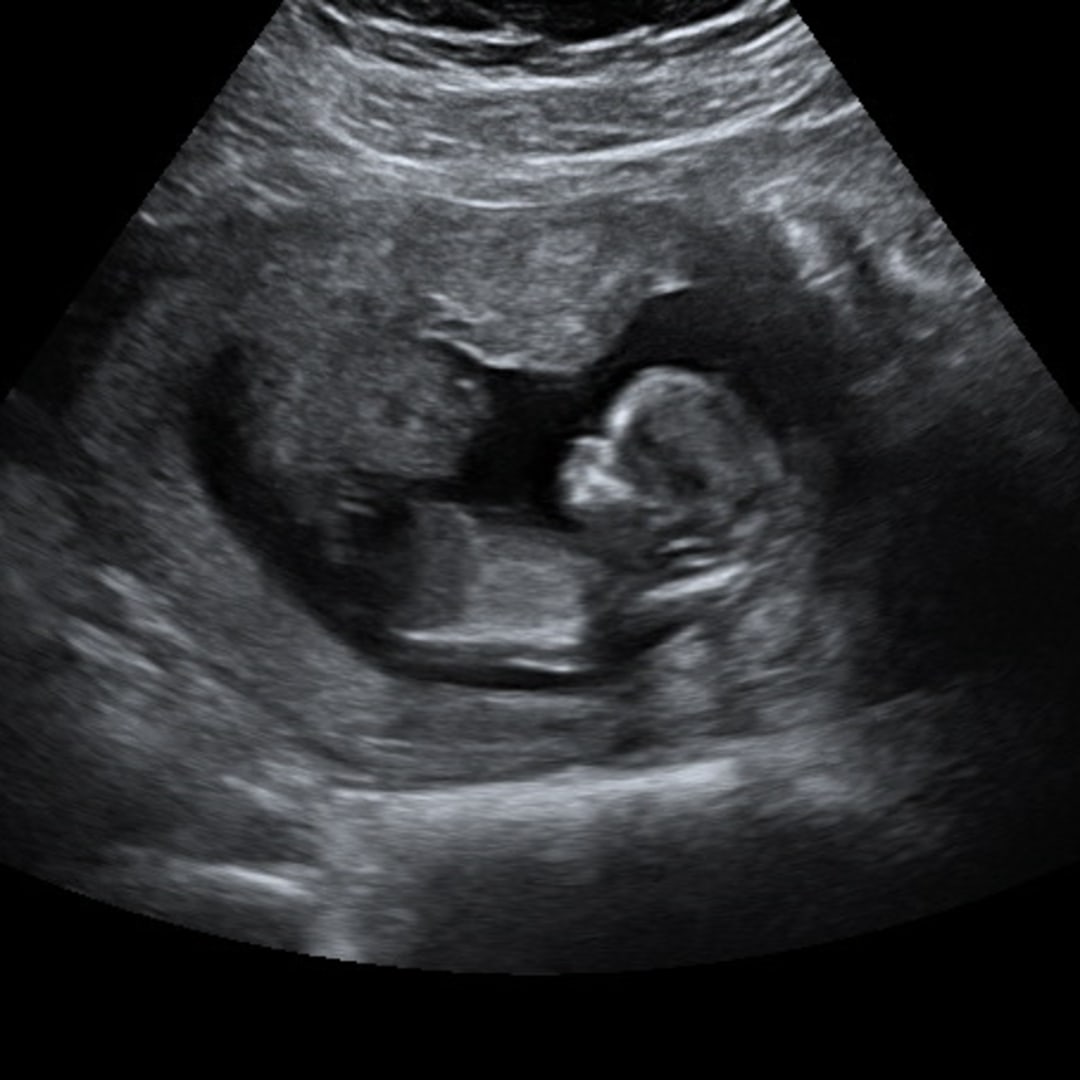 Photo shared by Kelsey for their Babylist baby registry.