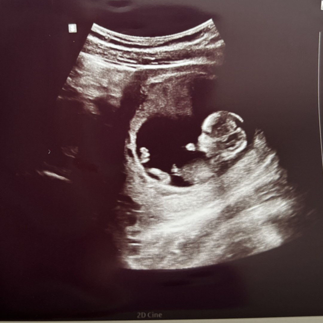 Photo shared by Julia for their Babylist baby registry.