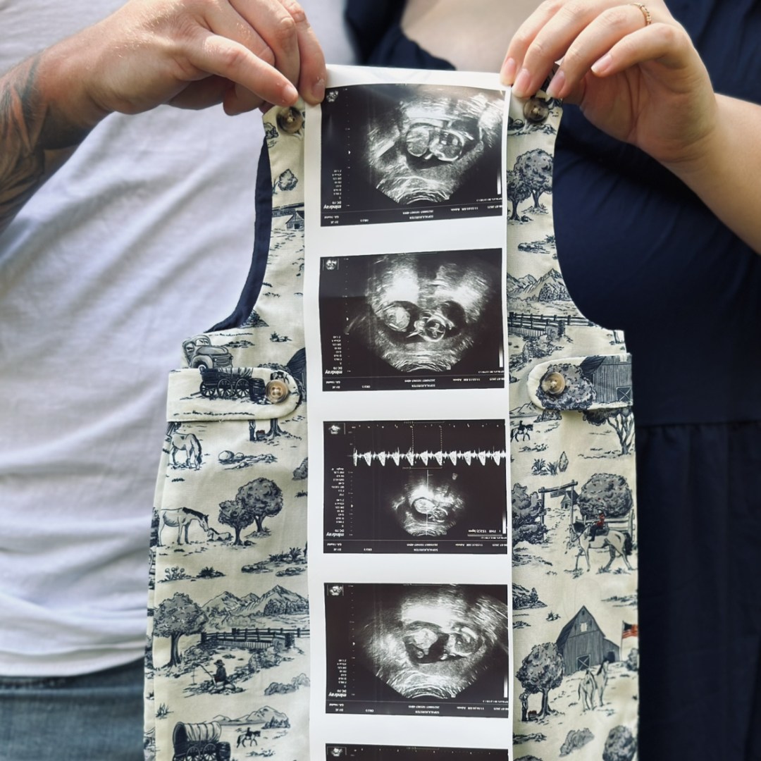 Photo shared by Kursten for their Babylist baby registry.
