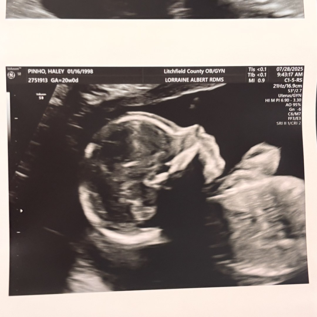 Photo shared by Haley for their Babylist baby registry.