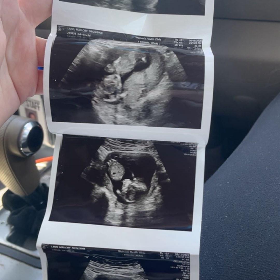 Photo shared by Mallory for their Babylist baby registry.