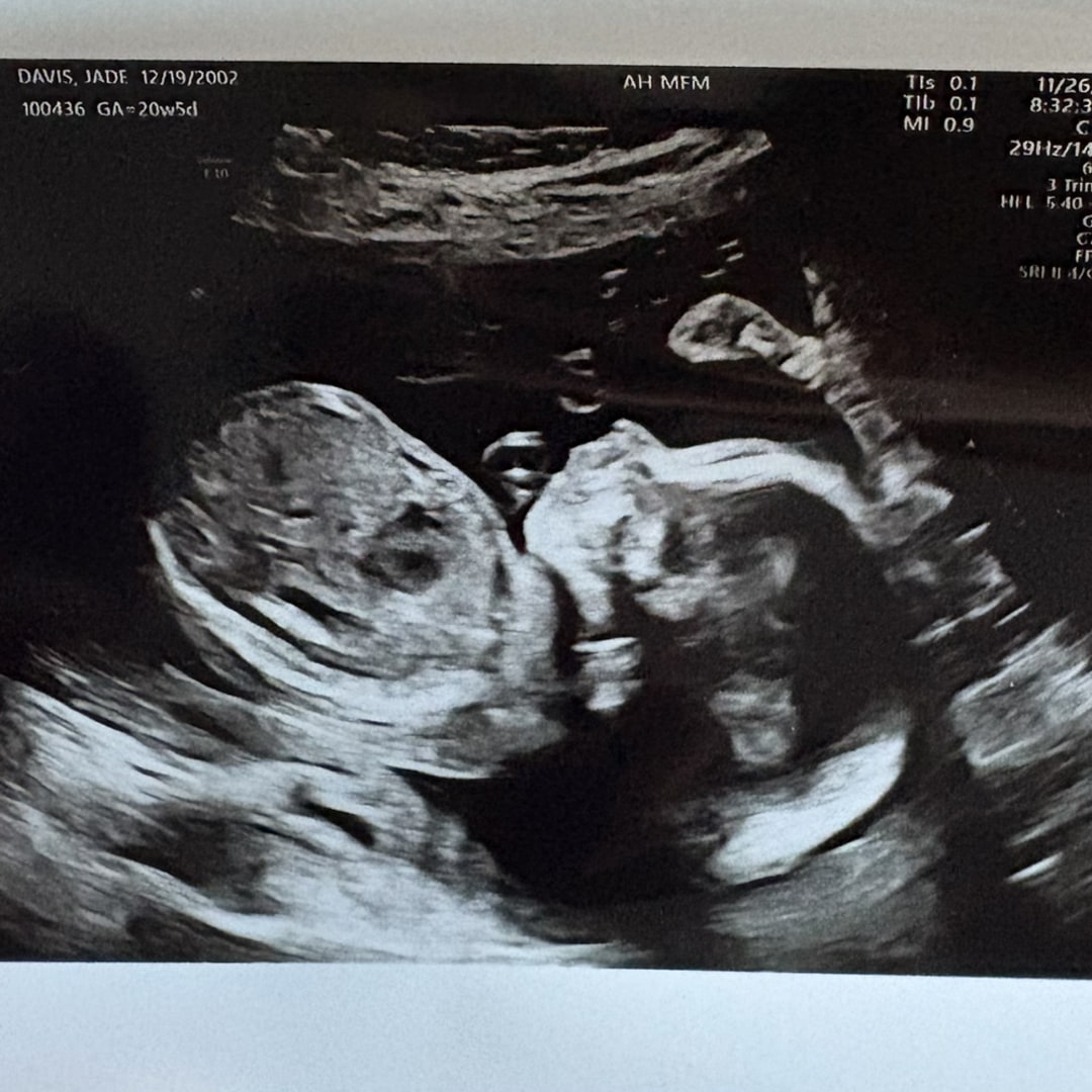 Photo shared by Jade for their Babylist baby registry.