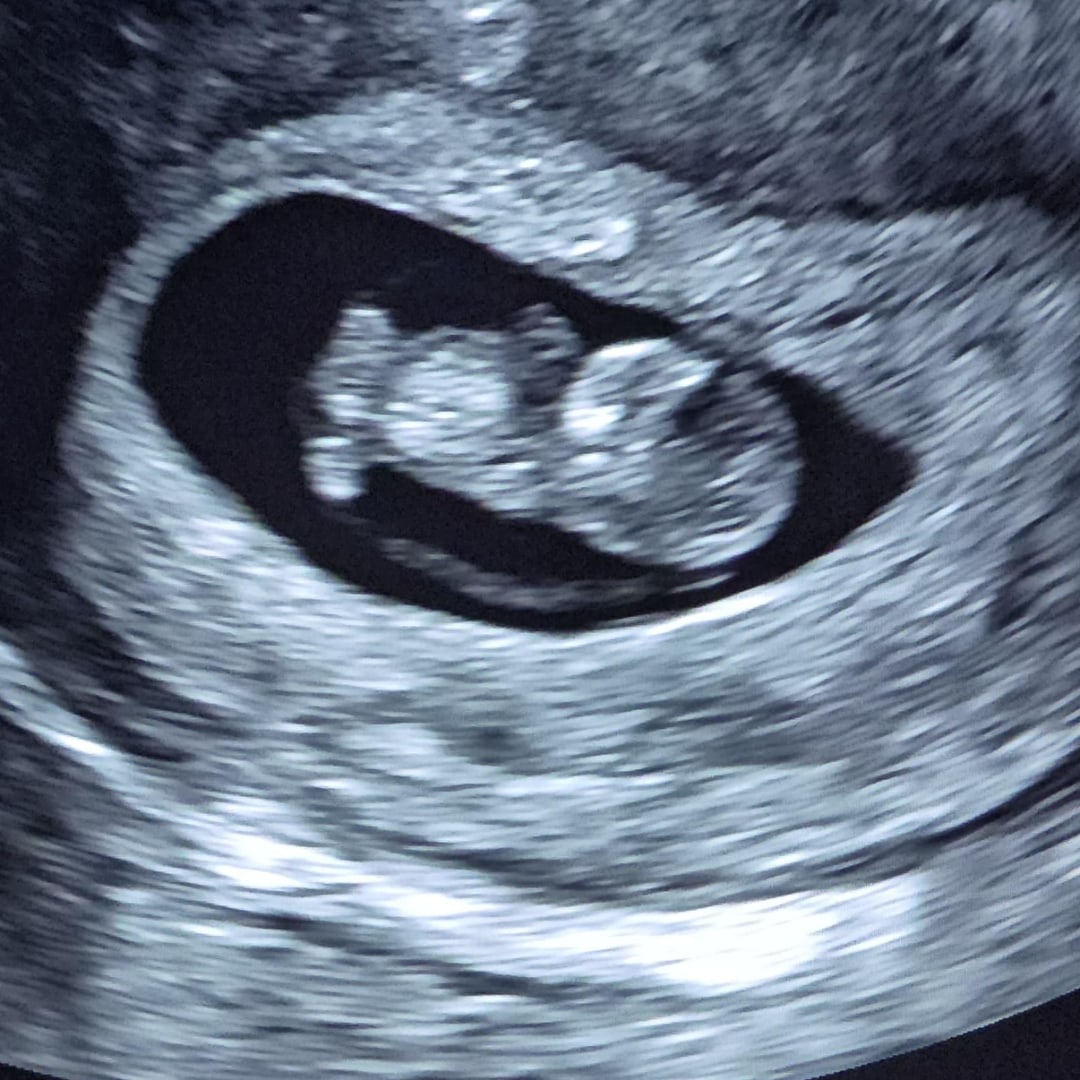 Photo shared by Elvira Elsa for their Babylist baby registry.