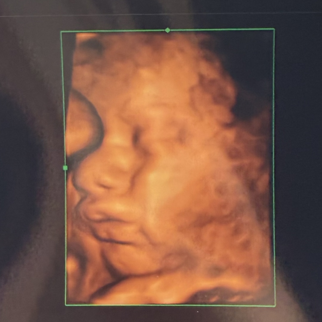 Photo shared by Emma for their Babylist baby registry.