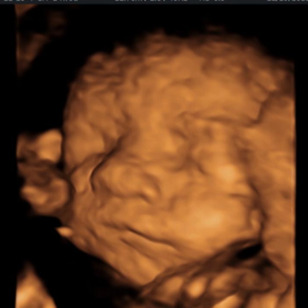 Photo shared by Erika for their Babylist baby registry.