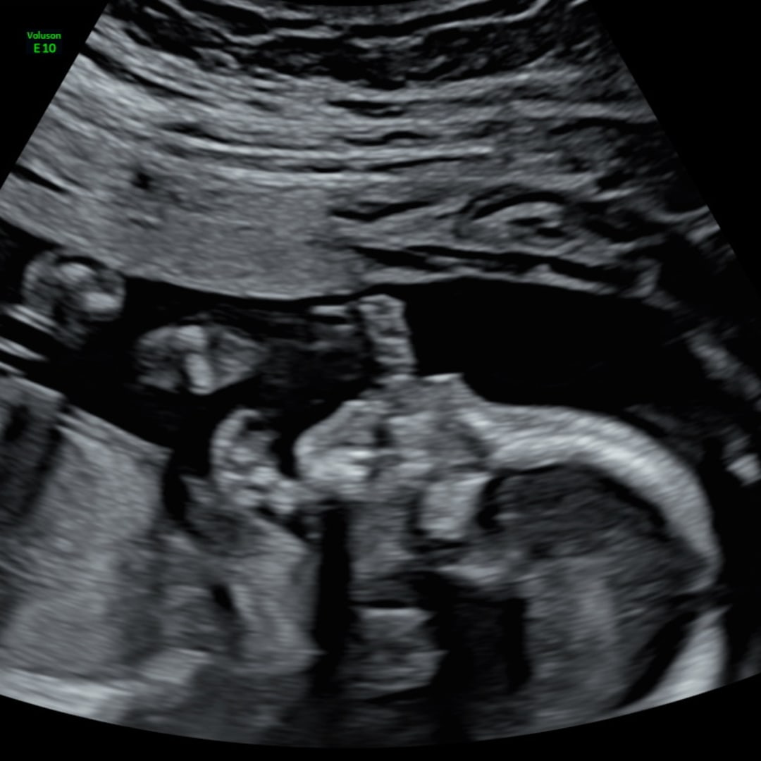Photo shared by Janese for their Babylist baby registry.