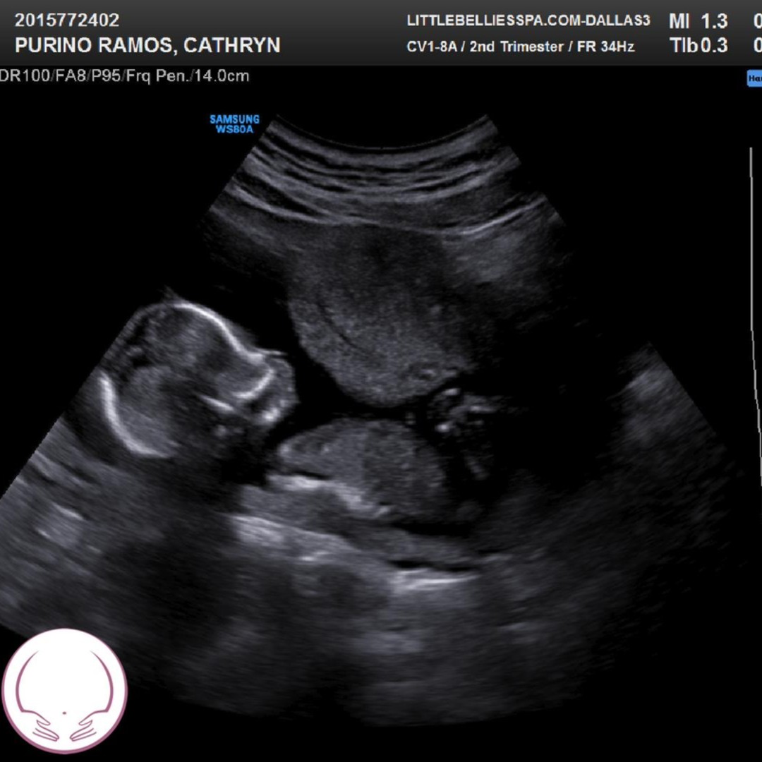 Photo shared by CJ for their Babylist baby registry.