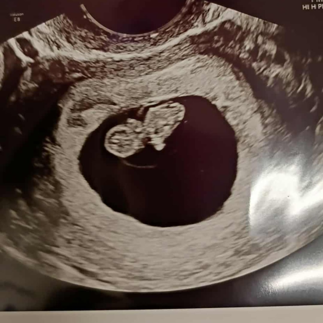 Photo shared by Alayna for their Babylist baby registry.