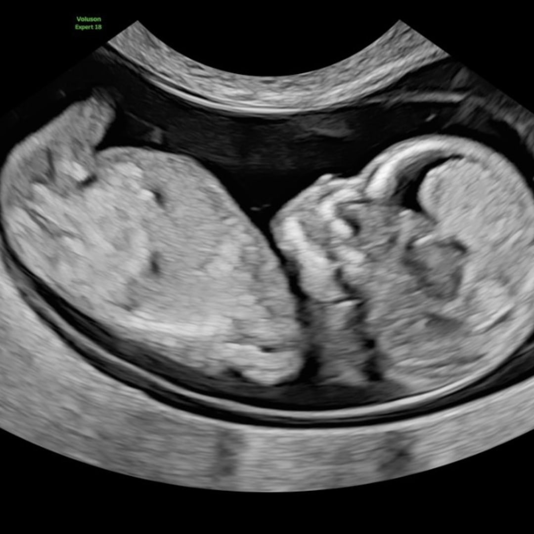 Photo shared by Kristy for their Babylist baby registry.
