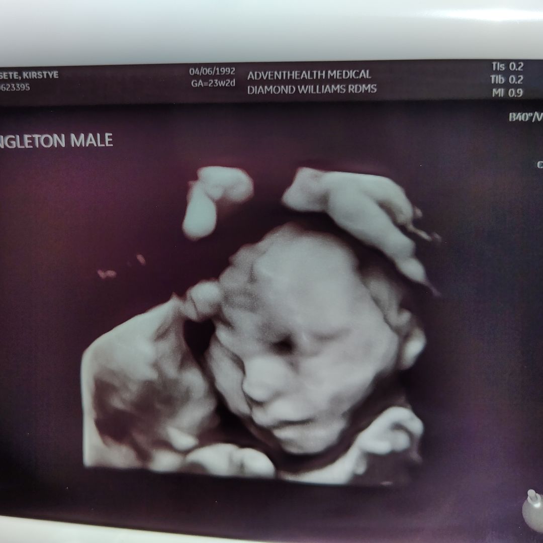 Photo shared by Kirstye for their Babylist baby registry.