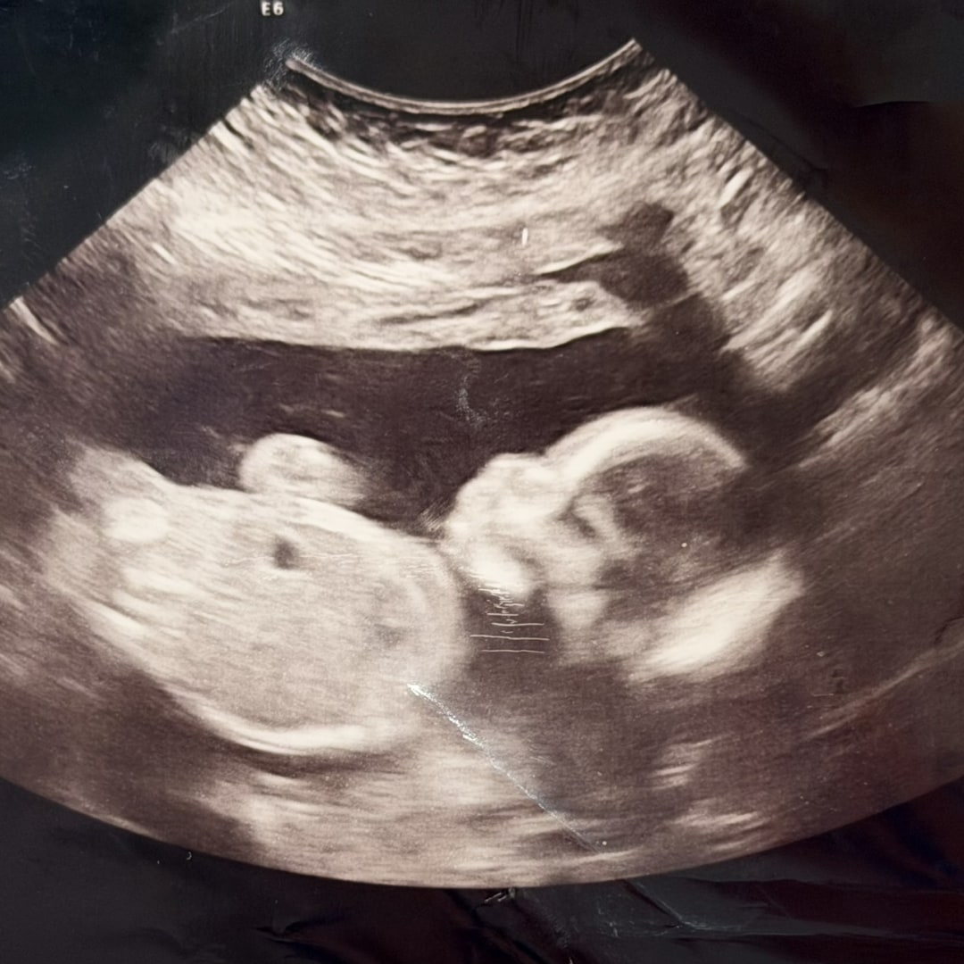 Photo shared by Sara for their Babylist baby registry.