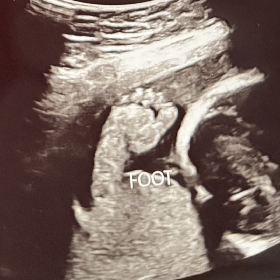 Photo shared by Chloe for their Babylist baby registry.