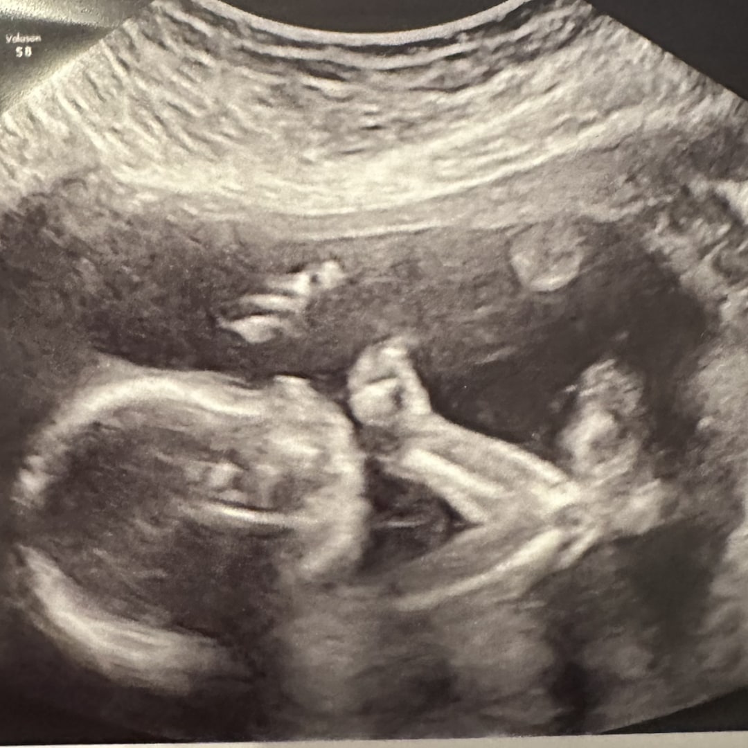 Photo shared by Kathryn for their Babylist baby registry.