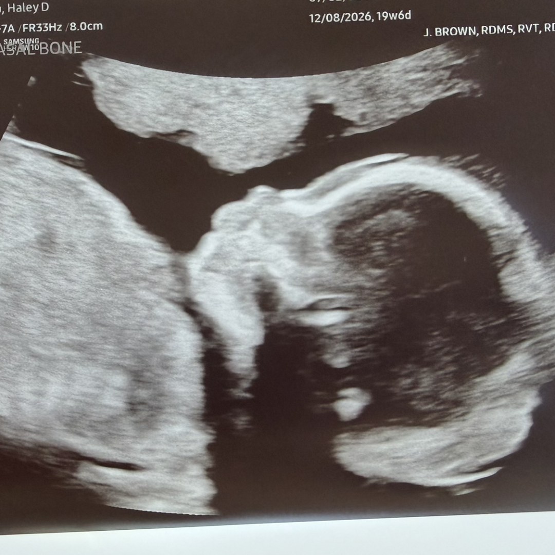 Photo shared by Haley for their Babylist baby registry.
