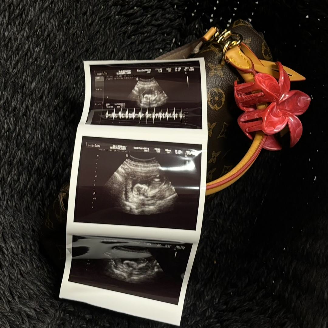 Photo shared by Anna for their Babylist baby registry.