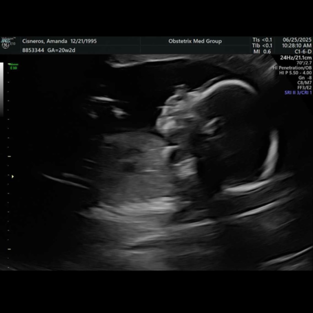 Photo shared by Amanda for their Babylist baby registry.