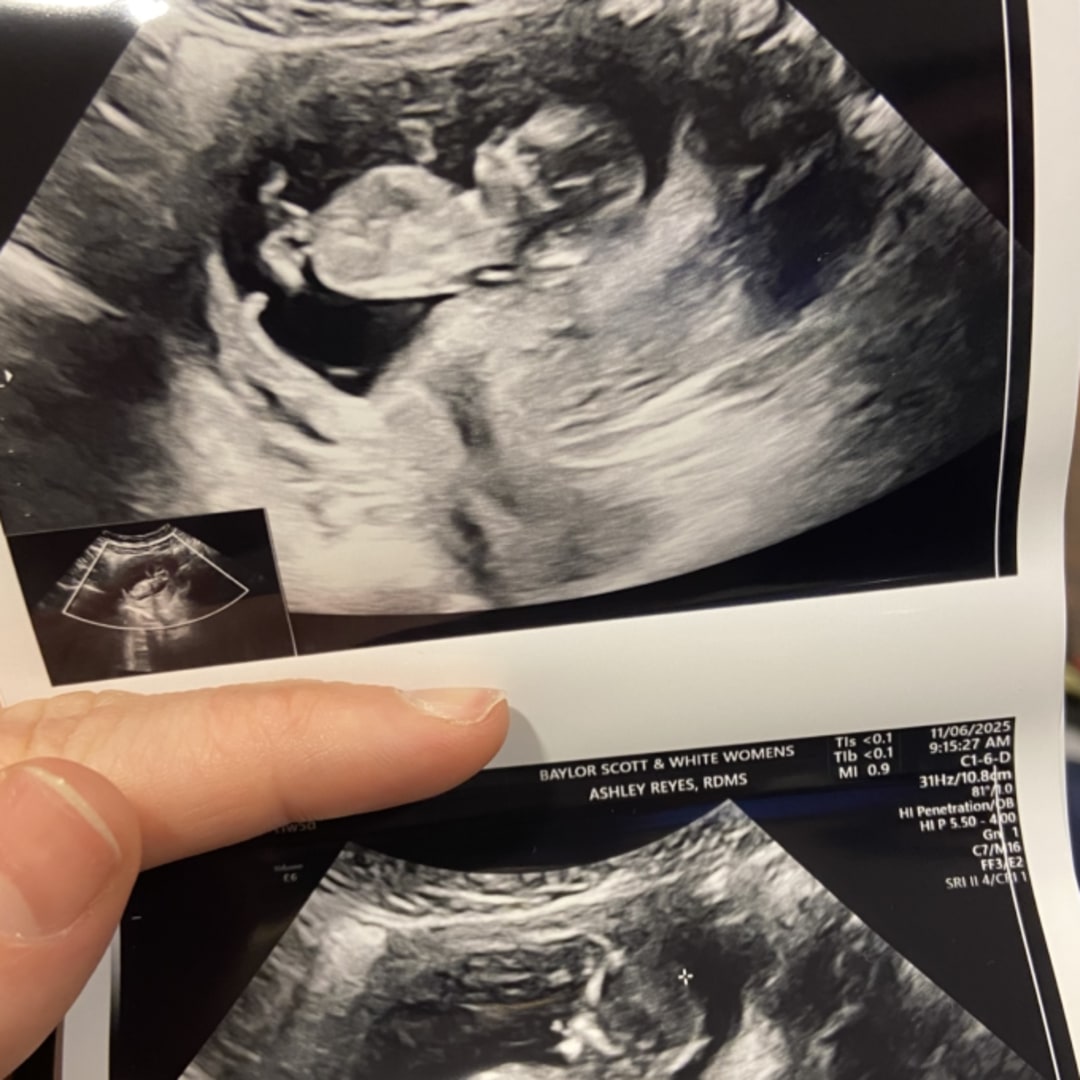 Photo shared by Samantha for their Babylist baby registry.