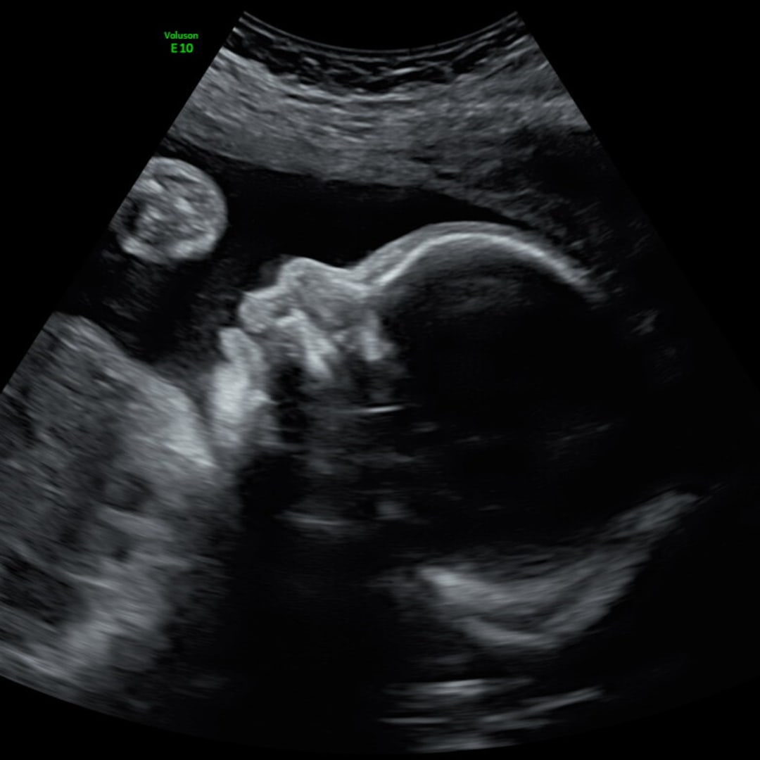 Photo shared by Lisse for their Babylist baby registry.