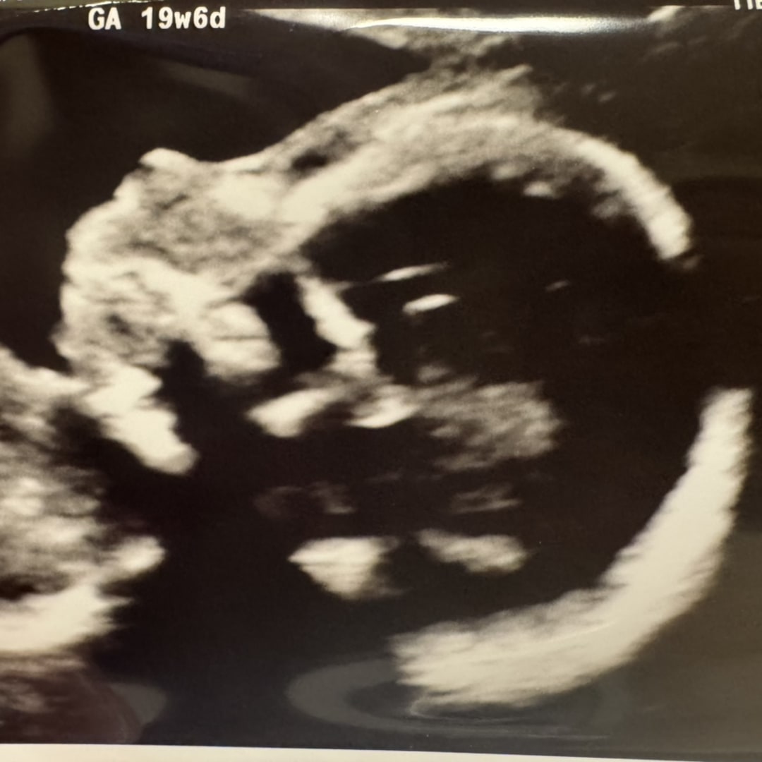 Photo shared by Erica for their Babylist baby registry.