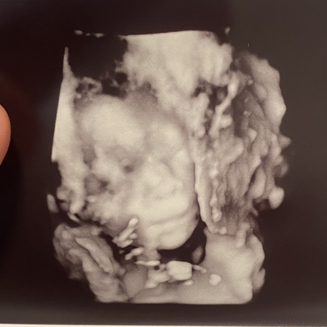 Photo shared by Lauren for their Babylist baby registry.