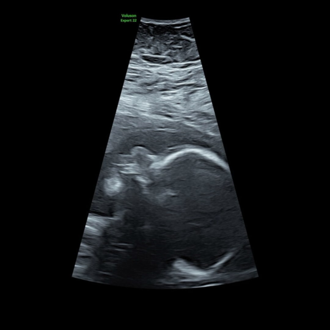 Photo shared by Hannya for their Babylist baby registry.