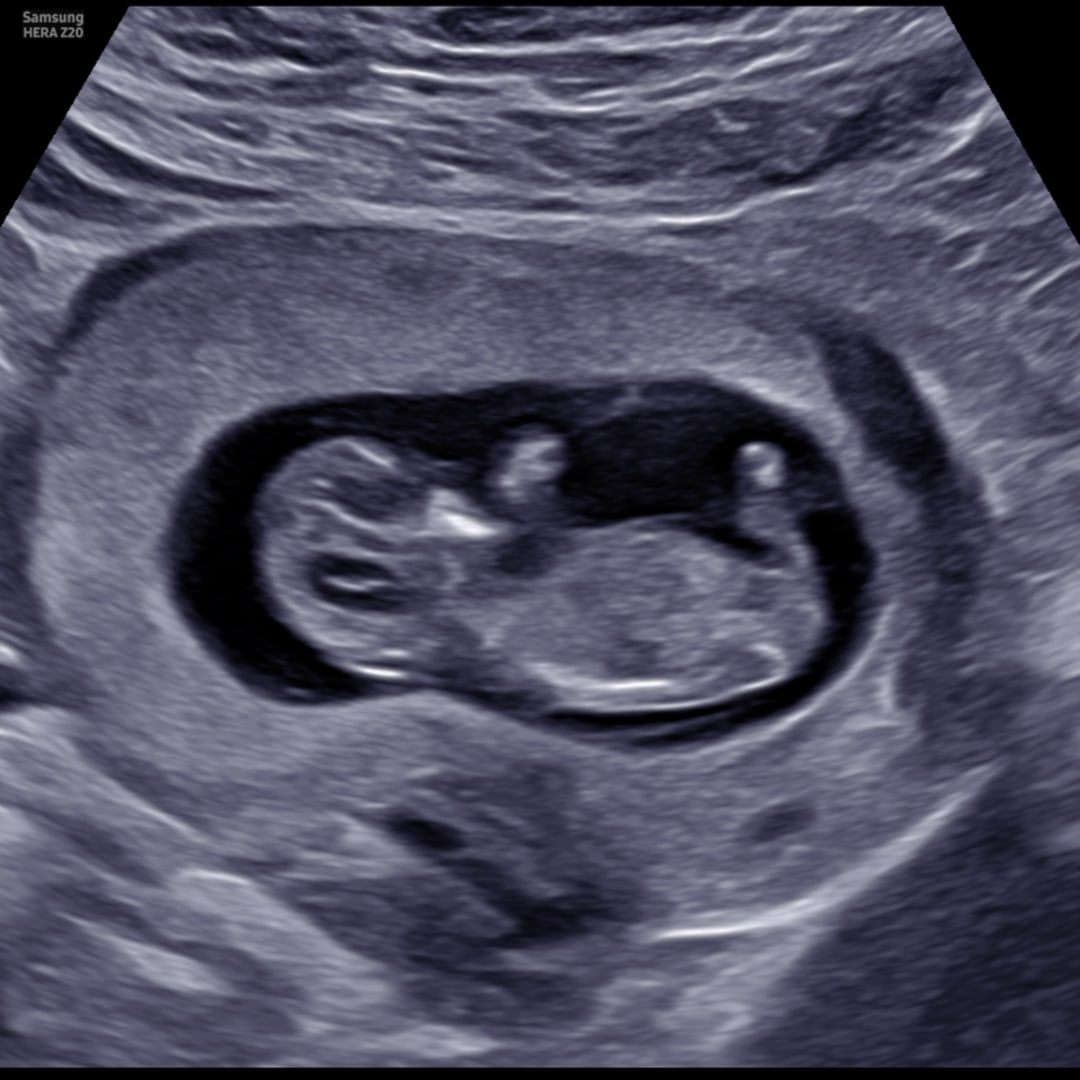 Photo shared by Marissa for their Babylist baby registry.