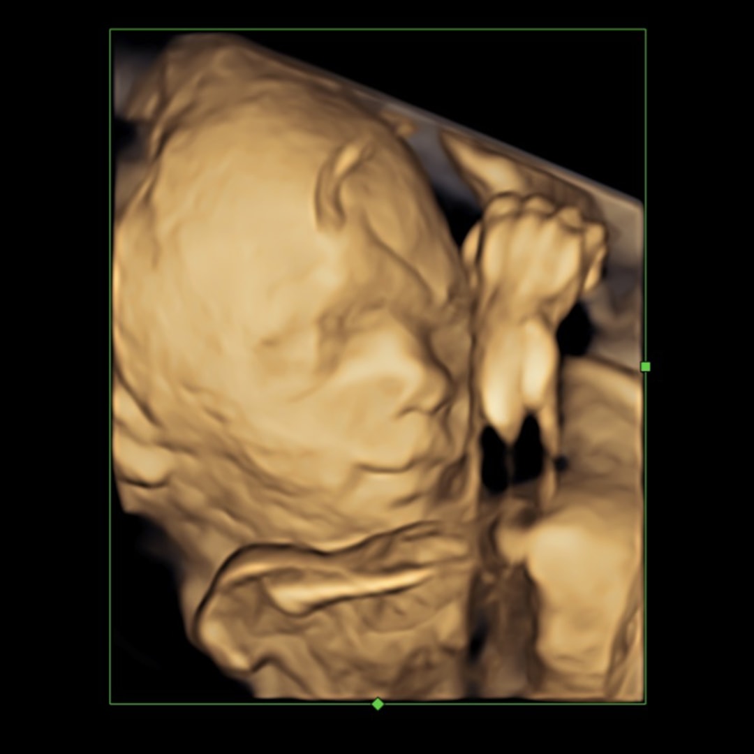 Photo shared by Gabby for their Babylist baby registry.