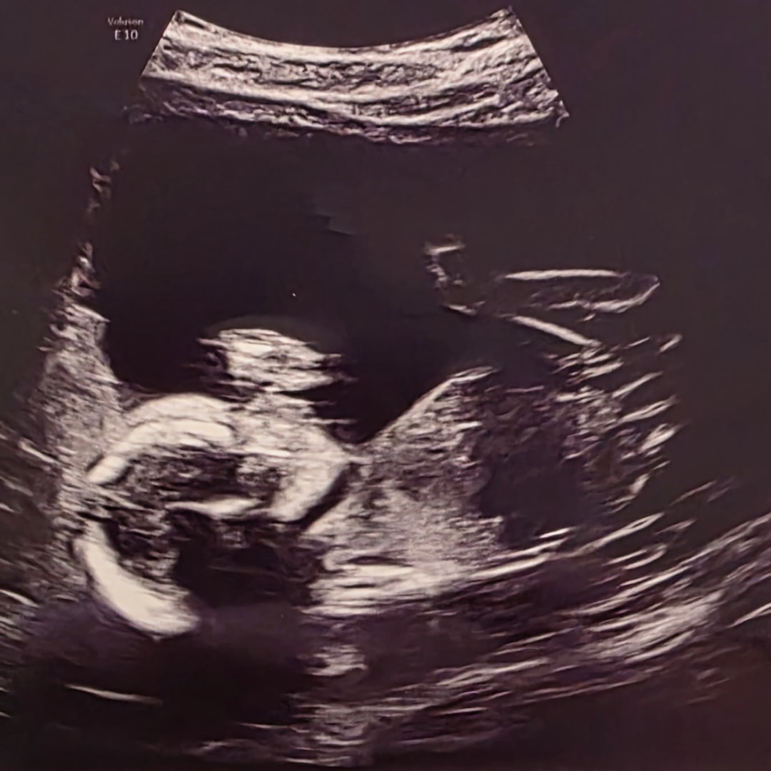 Photo shared by Meghan for their Babylist baby registry.