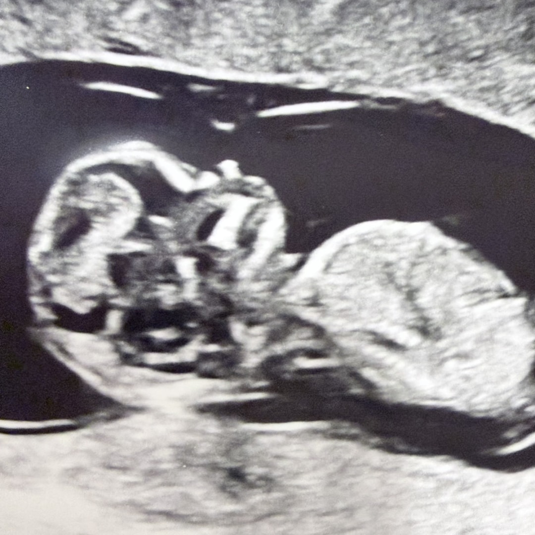 Photo shared by Daniela for their Babylist baby registry.