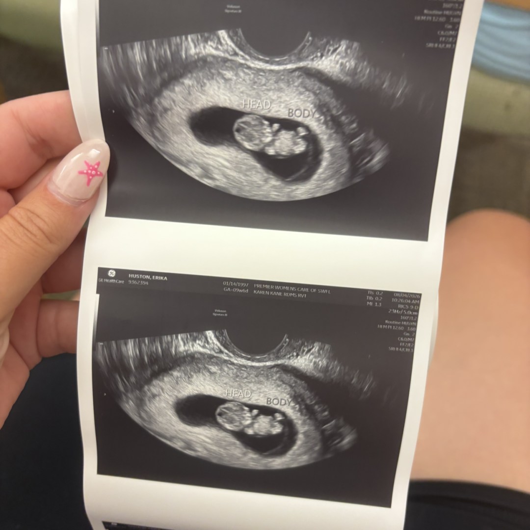 Photo shared by Erika for their Babylist baby registry.