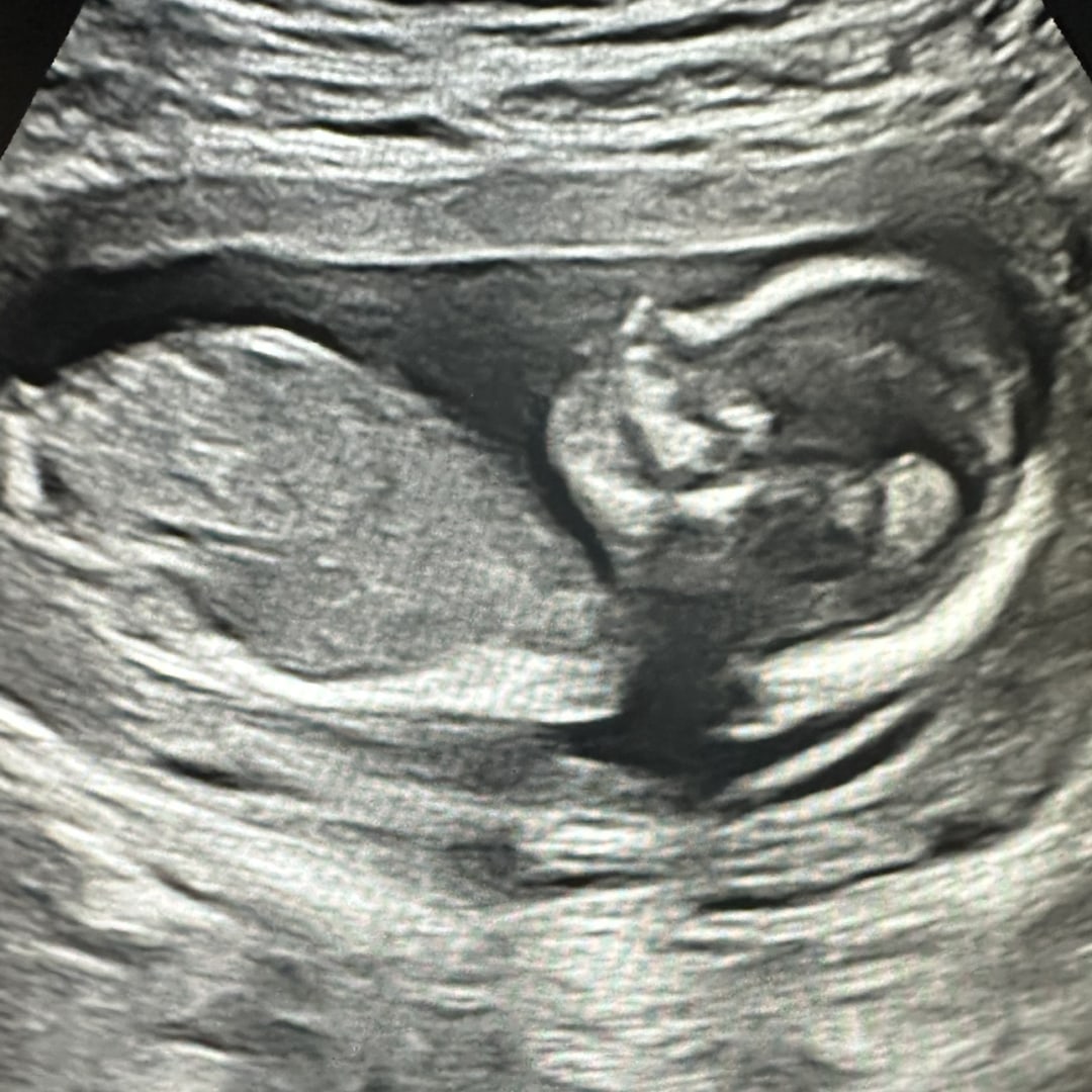 Photo shared by Cheyenne for their Babylist baby registry.