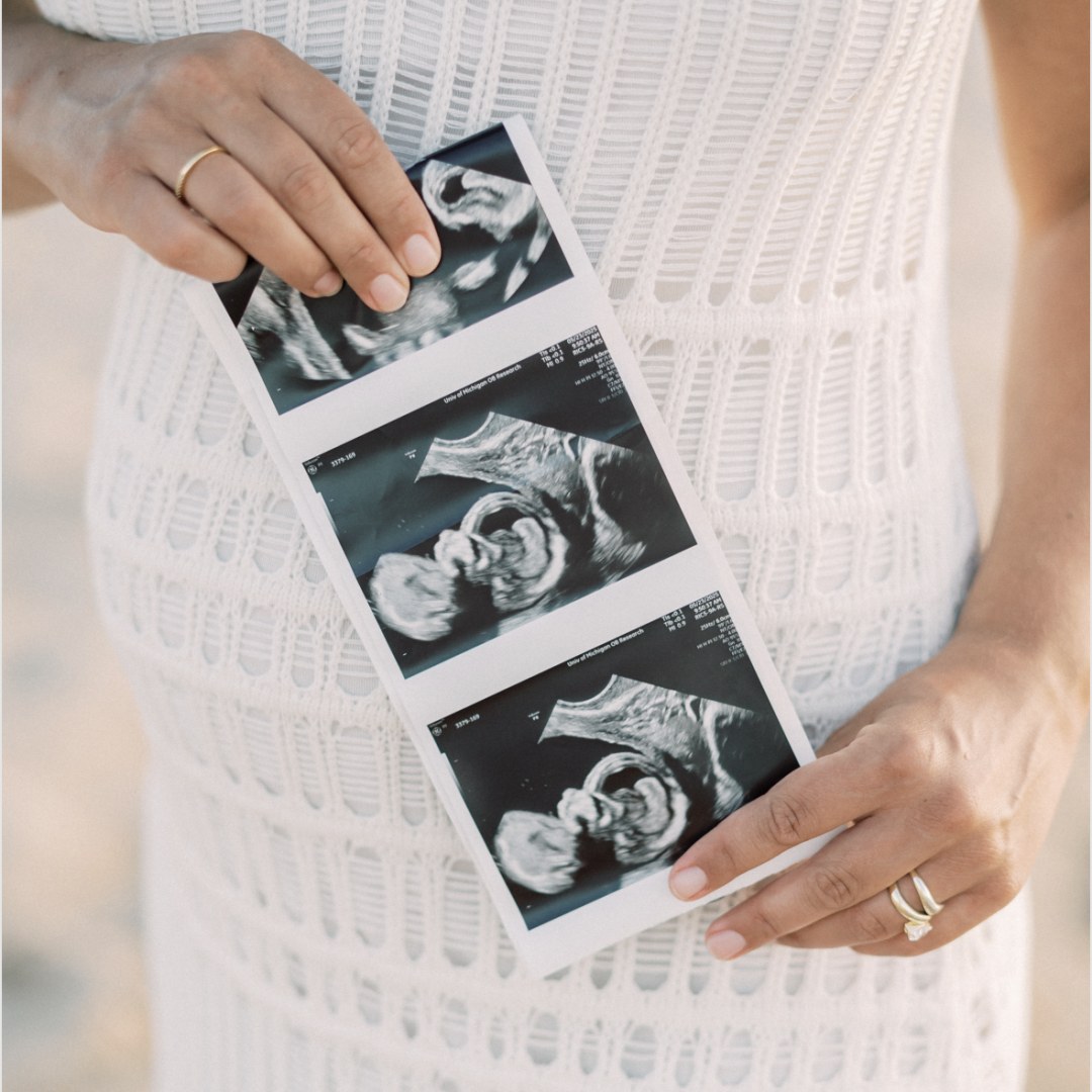 Photo shared by Kathleen for their Babylist baby registry.