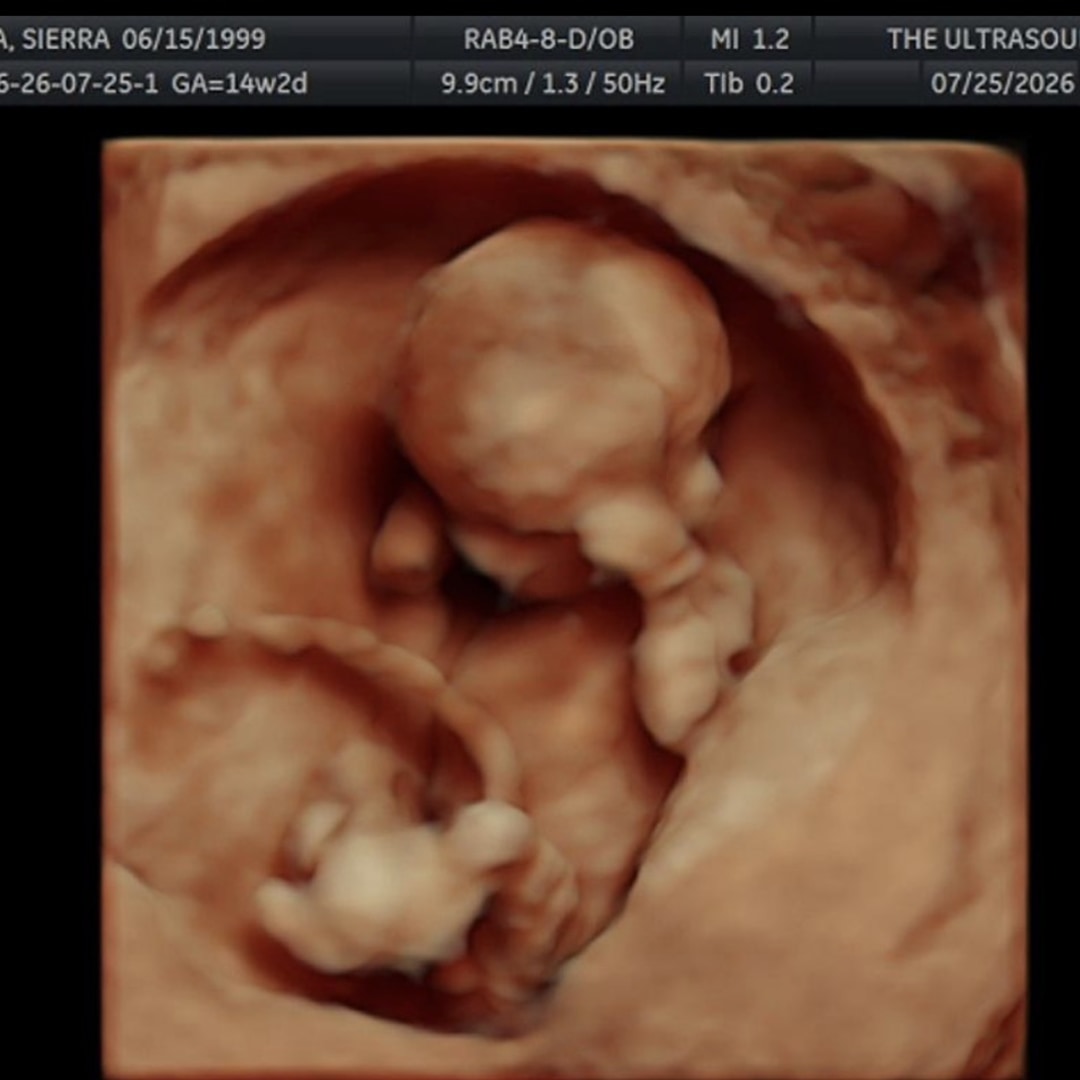 Photo shared by Sierra for their Babylist baby registry.