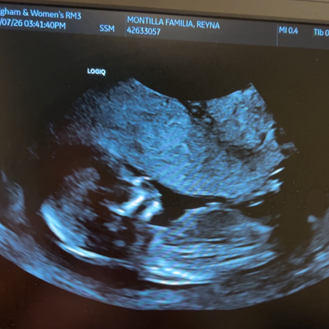 Photo shared by Reyna for their Babylist baby registry.