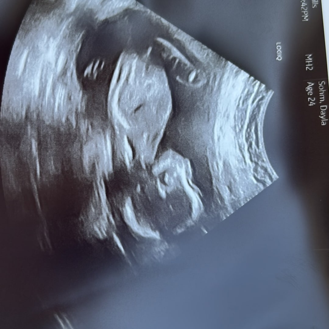 Photo shared by Dayla for their Babylist baby registry.