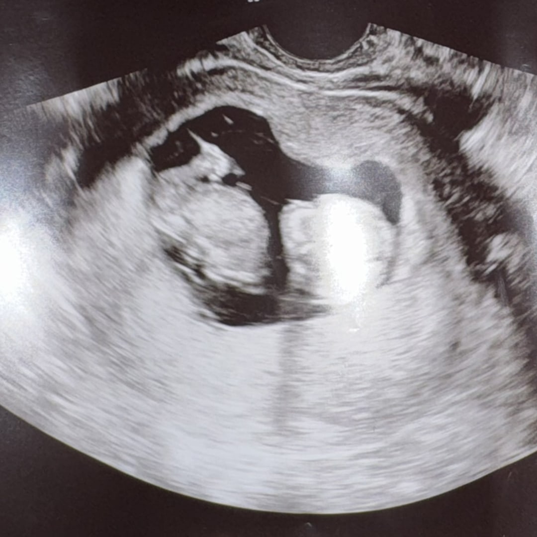 Photo shared by Ina for their Babylist baby registry.