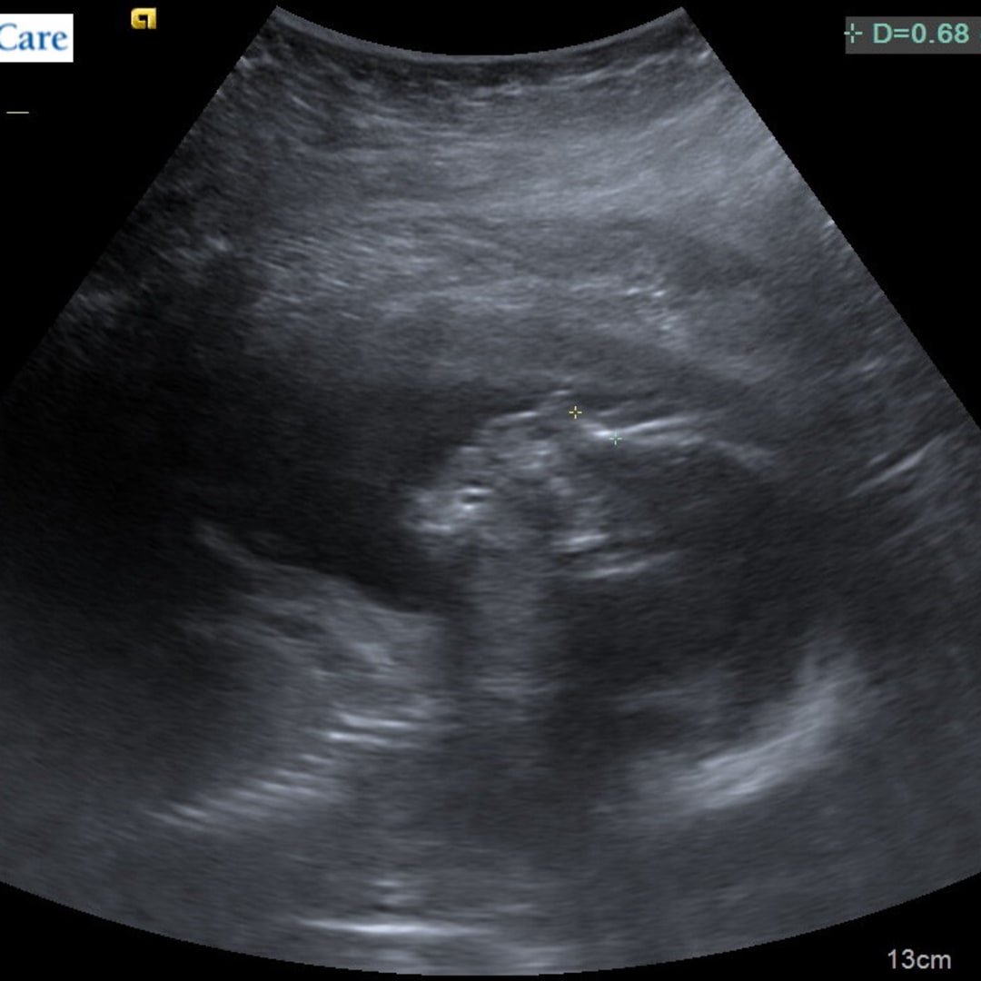 Photo shared by Sarah for their Babylist baby registry.